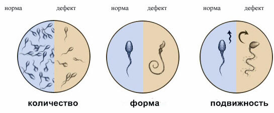 Как сдают сперму в банк правильно?
