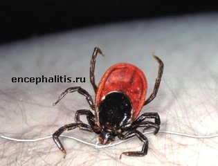 удаление клещей ниткой