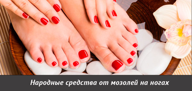 лечение мозолей народными средствами