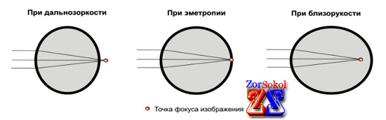Три вида оптической системы