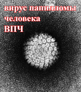 причина бородавок - ВПЧ
