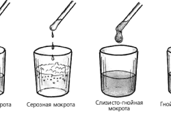 Виды мокроты при кашле