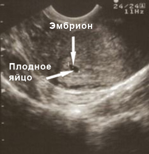 Третья неделя беременности