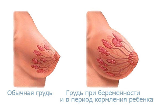 Изменение груди во время беременности