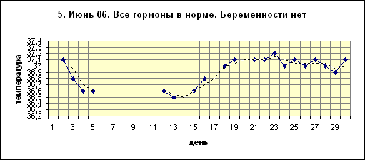 БТ