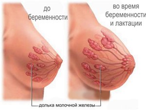Причины болей в груди во время беременности